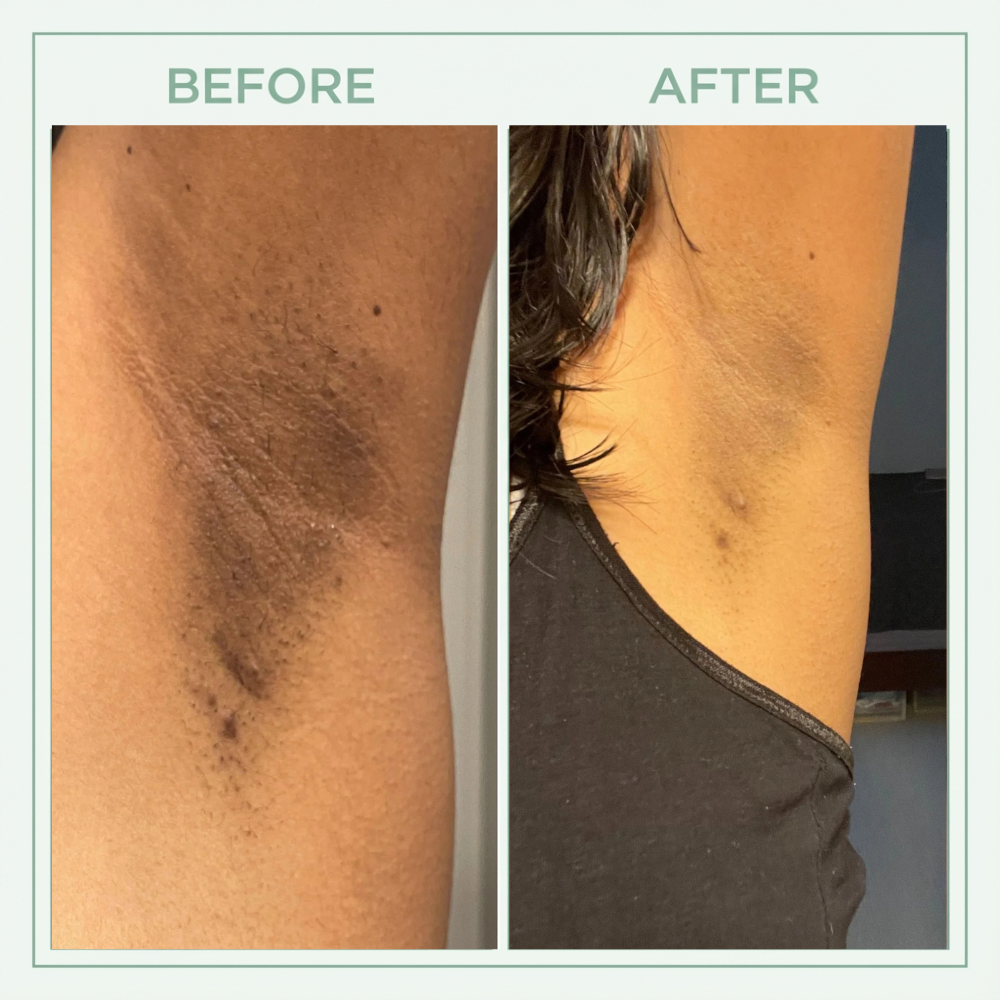 Tkhotpick™ Bright Peel Spray