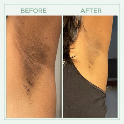 Tkhotpick™ Bright Peel Spray