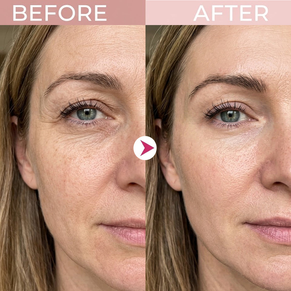 ✨ Retinol Eye Renewal Cream – Lightweight Hydrating & Gentle Eye Care for Fine Lines, Dark Circles & Puffiness