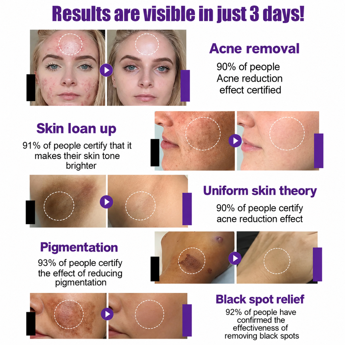 Highly effective whitening and spot-lightening cream