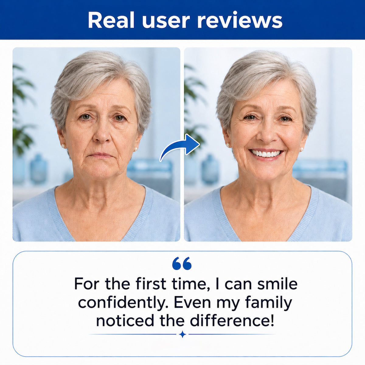 🦷 Comfort-Fit Dentures – Natural-Looking Smile for Everyday Wear