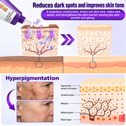 Highly effective whitening and spot-lightening cream