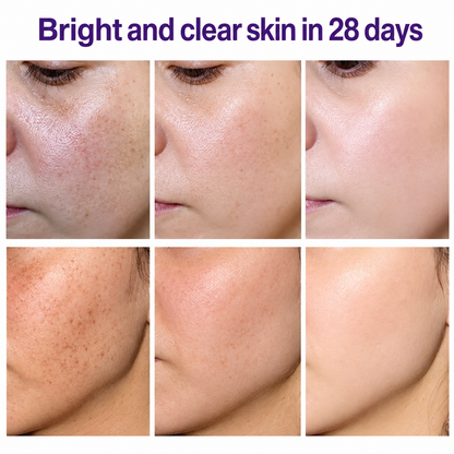 Highly effective whitening and spot-lightening cream