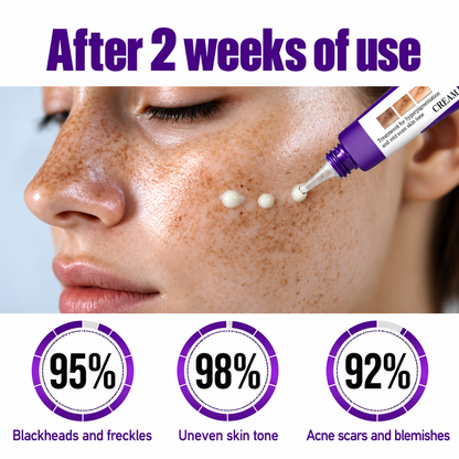 Highly effective whitening and spot-lightening cream