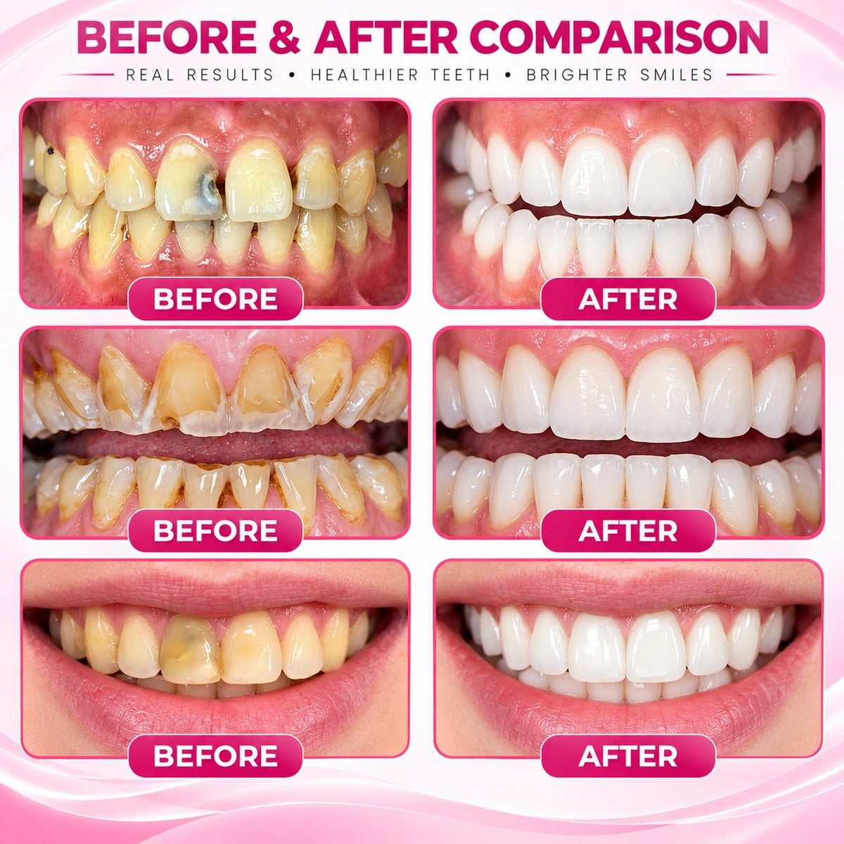 ✨Natural Enamel Care Dental Gel