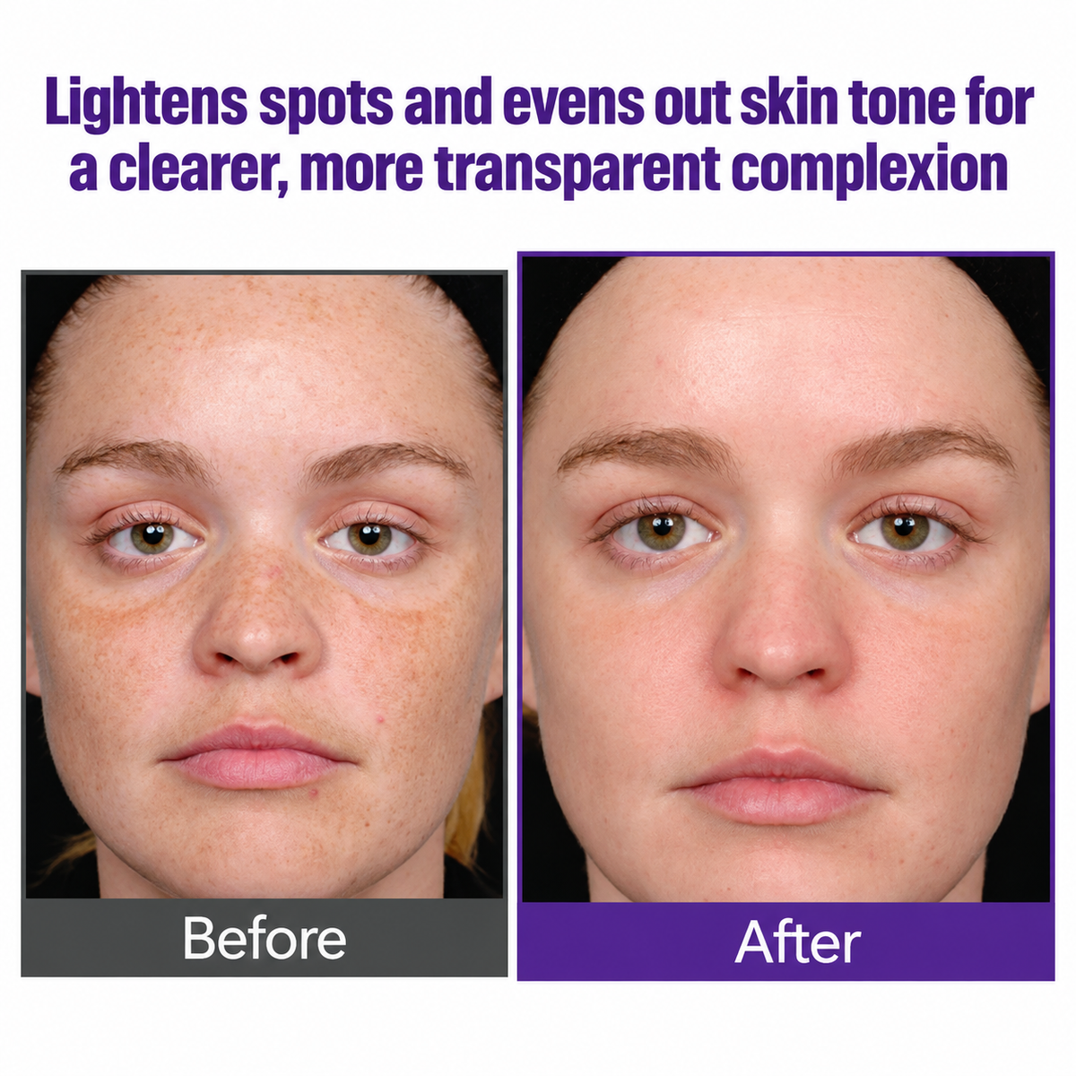 Highly effective whitening and spot-lightening cream