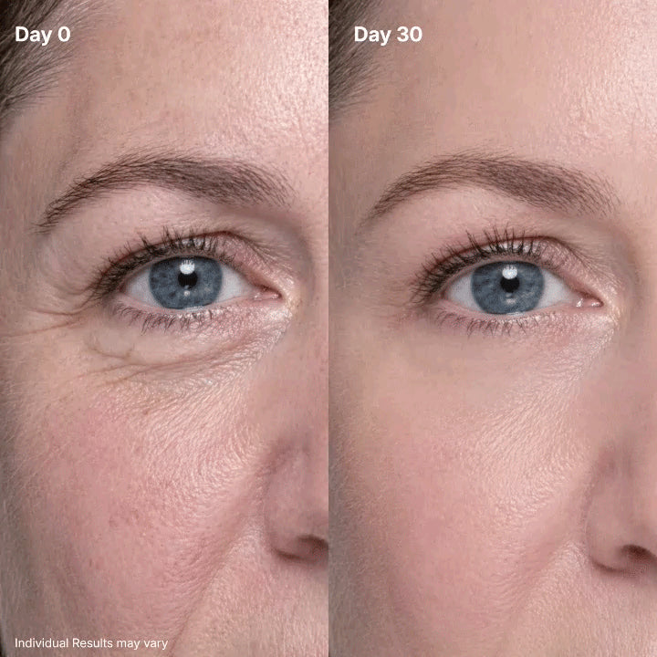 Eye contour comparison showing the appearance of fine lines