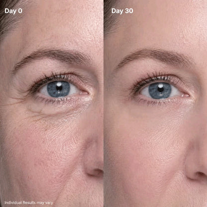 ✨ Retinol Eye Renewal Cream – Lightweight Hydrating & Gentle Eye Care for Fine Lines, Dark Circles & Puffiness