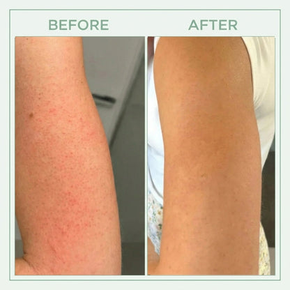 Tkhotpick™ Bright Peel Spray